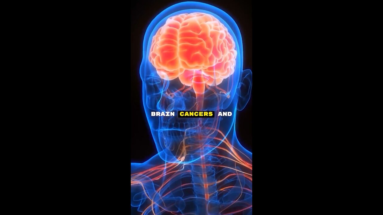 Cell Phones Have Been Around Long Enough, Studies Show It Causes Cancer & Other Diseases! Michael Gibson