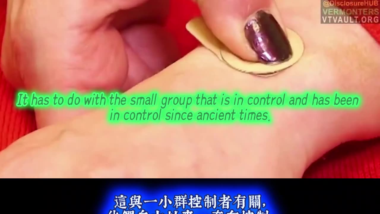 Nanopatch and GMO - The Forever Biomarker of Slave