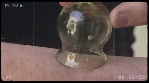 Why People Died So Young In The Middle Ages