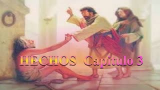 "Hechos Capitulo 3 " Devocional