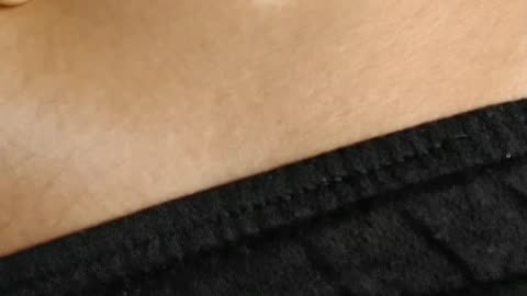 Branding on hip from SRA Br33ding Pr0grams