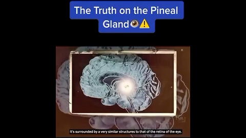 PINEAL GLAND, Seat of our SOUL ~ Unlock the Power of Your Third Eye 👁️ ✨ Rid Body of Fluoride