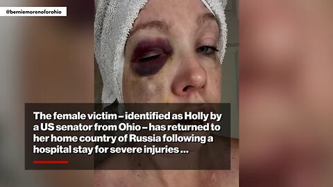 New pics show Cincinnati brawl victim beaten to BLOODY pulp