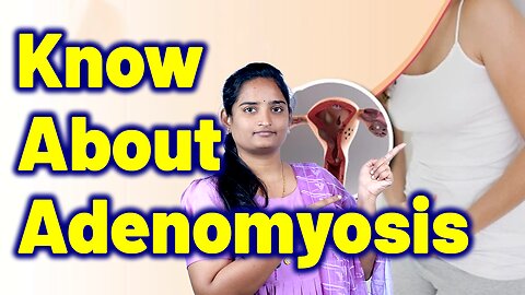 What Is Adenomyosis In Women | Painful Uterus Condition, Heavy Bleeding Uterus. Homeopathy Medicine