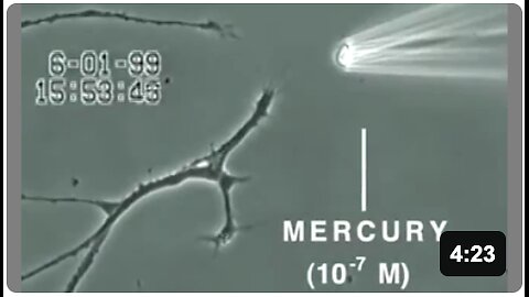 How Mercury Kills the Brain - Autism CURE:RAW MILK