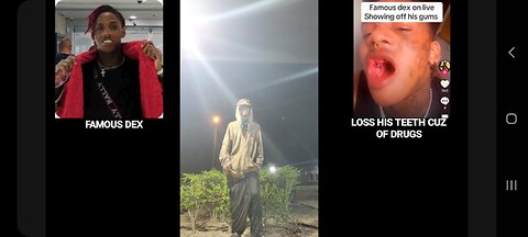 FAMOUS DEX LETT DA DRUGS N SUCCESS RUIN HIM HE LOSS ALL HIS TEETH DA DOWN OF DEX CAN HE COME BACC💪🏾🔵