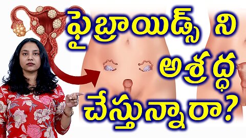 ఫైబ్రాయిడ్స్ ని అశ్రద్ద చేస్తున్నారా? Neglect Complicaions of Faibroids Homeopathy Treatment Cure