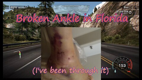 I Broke My Ankle in Florida! (I've Been Through It)