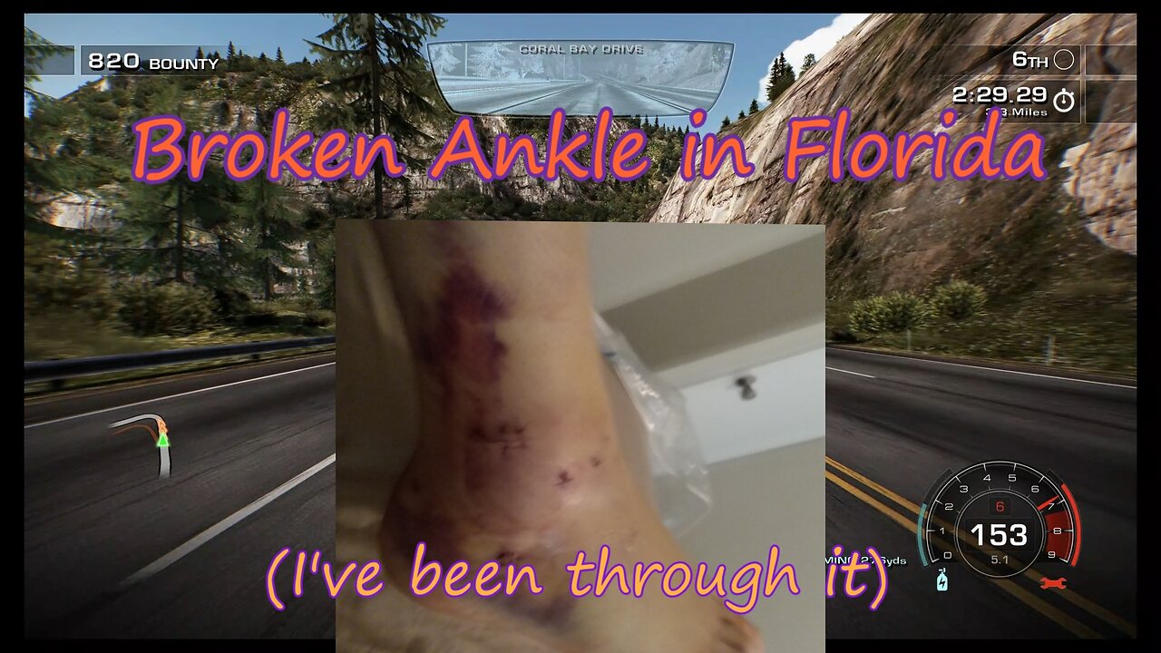 I Broke My Ankle in Florida! (I've Been Through It)
