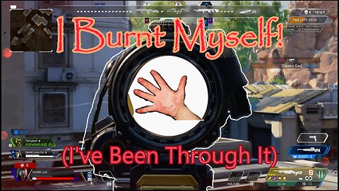 Burning My Hands Red By Accident! (I've Been Through It)