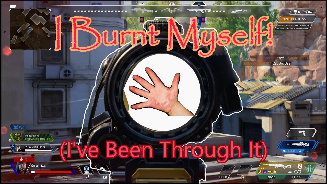 Burning My Hands Red By Accident! (I've Been Through It)
