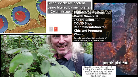 Suramin vs autism. Tree filter. Wars and Zionism. DARPA squid camouflage. Marry third cousins!?!