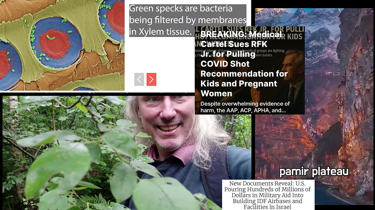 Suramin vs autism. Tree filter. Wars and Zionism. DARPA squid camouflage. Marry third cousins!?!