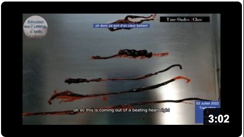 Horrifying BLACK GOO Removed from Beating Heart of Vaxxed