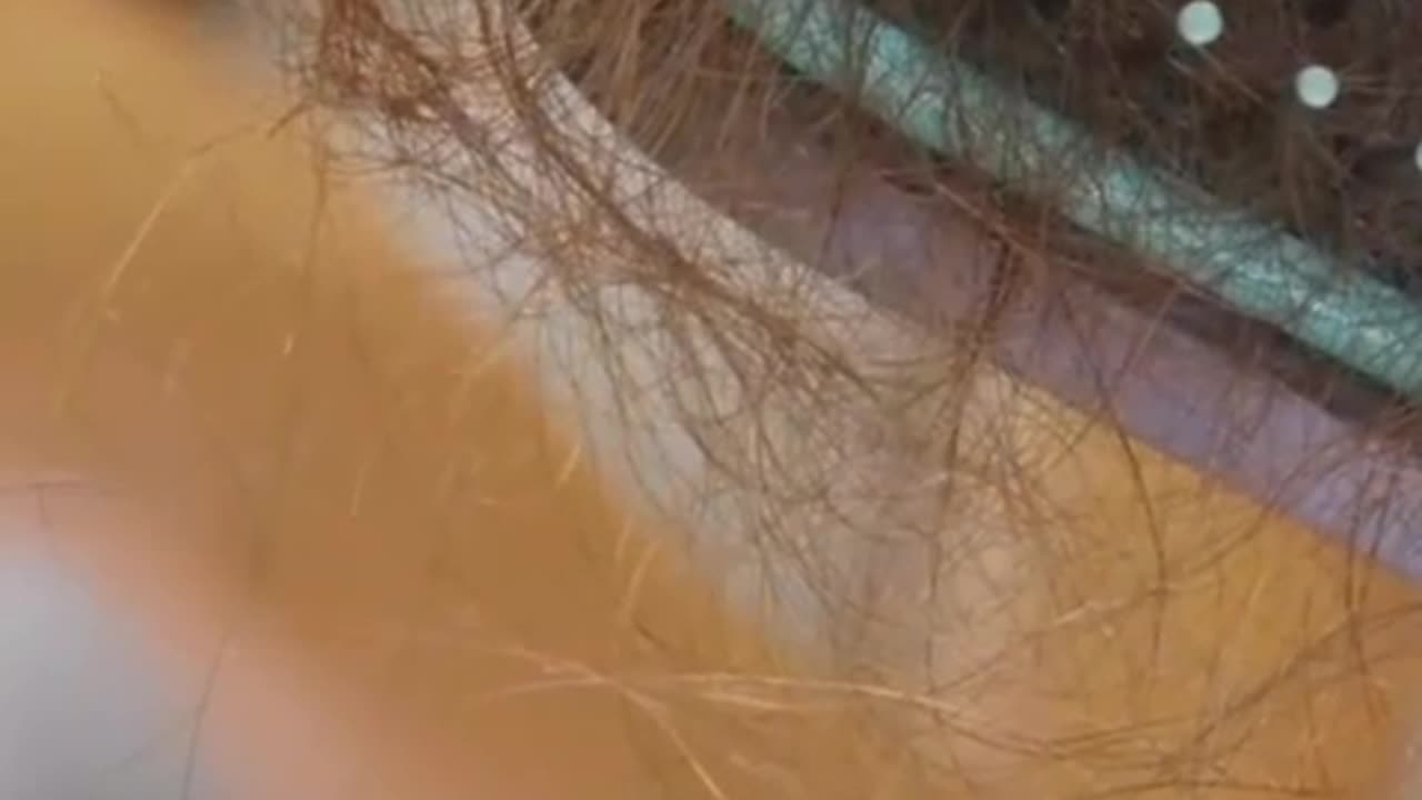 Why Hair Loss Happens: 8 Common Causes Explained