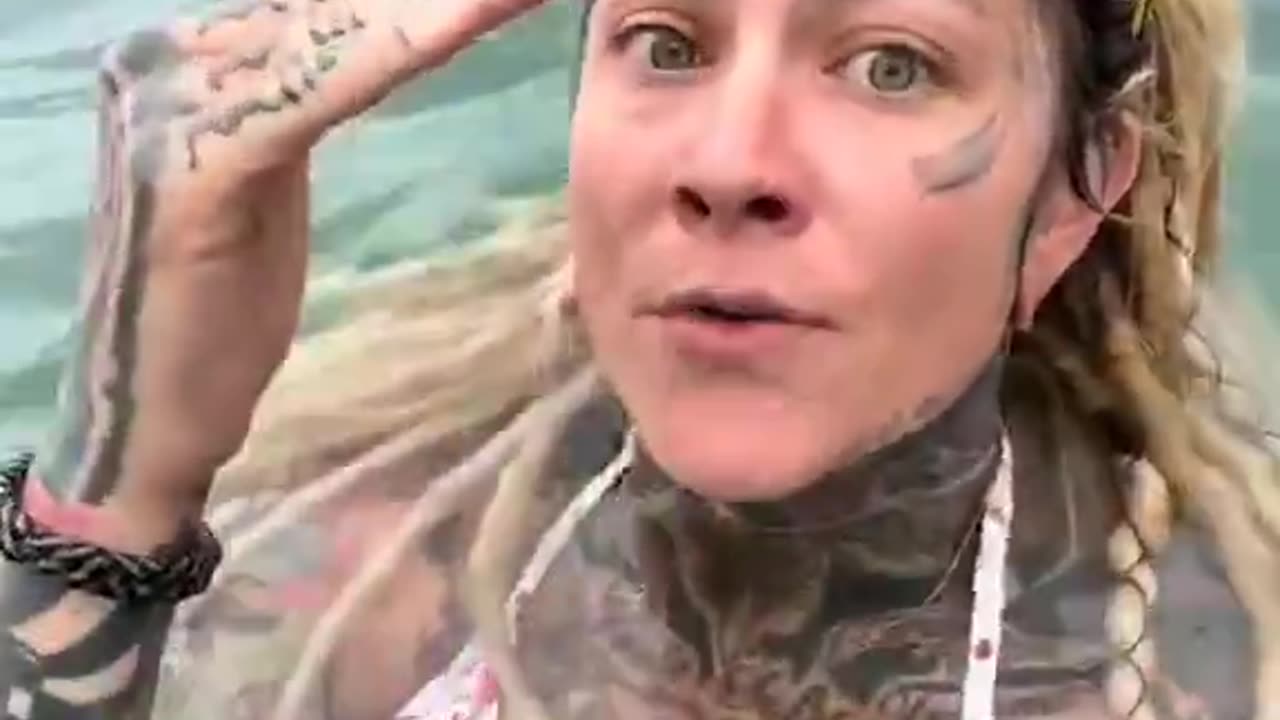 Herpes Issues