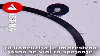 Microscope Analysis of Some Vaccines