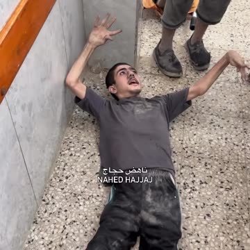 A child with special needs was injured and is not receiving treatment at Al-Shifa Hospital