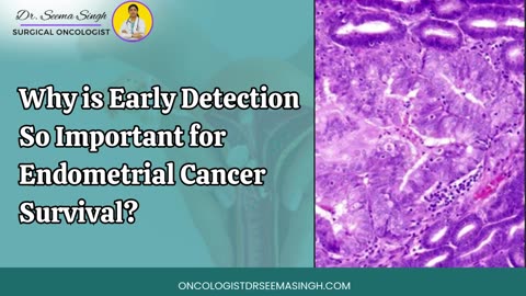 Why is Early Detection So Important for Endometrial Cancer Survival?