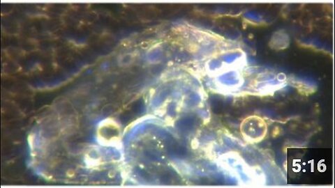 "Greg Reese Discovers Self-Replicating Nanobots in Both Vaccinated and Unvaccinated Individuals"
