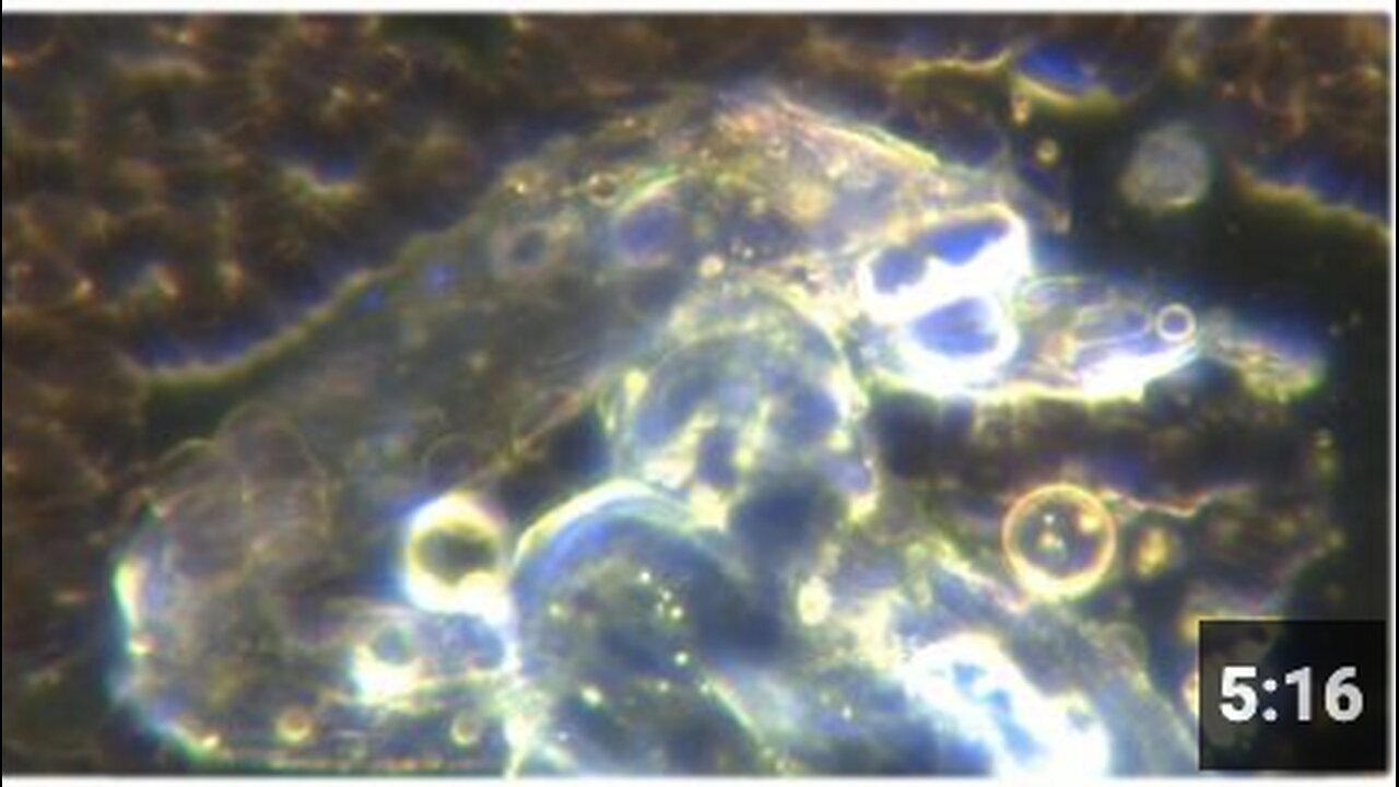 "Greg Reese Discovers Self-Replicating Nanobots in Both Vaccinated and Unvaccinated Individuals"