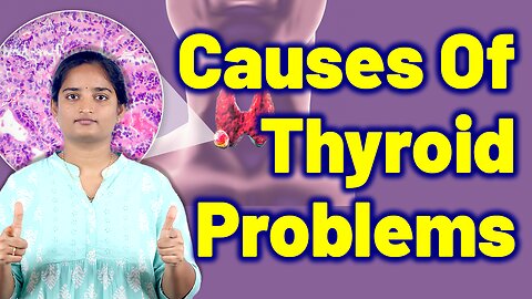 Causes Of Thyroid, Hypothyroidism, Hyperthyroidism | Homeopathy Treatment Medicine and Cure Surgery