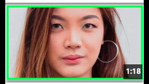 "TikTok Celebrity Dies from Vaccine-induced Aneurysm"