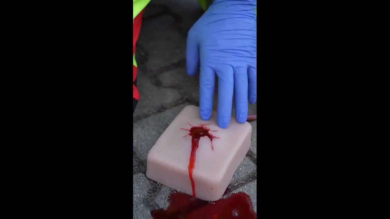 STOP the Bleed FAST: How to Pack a Wound and SAVE a Life (Trauma Survival Guide)
