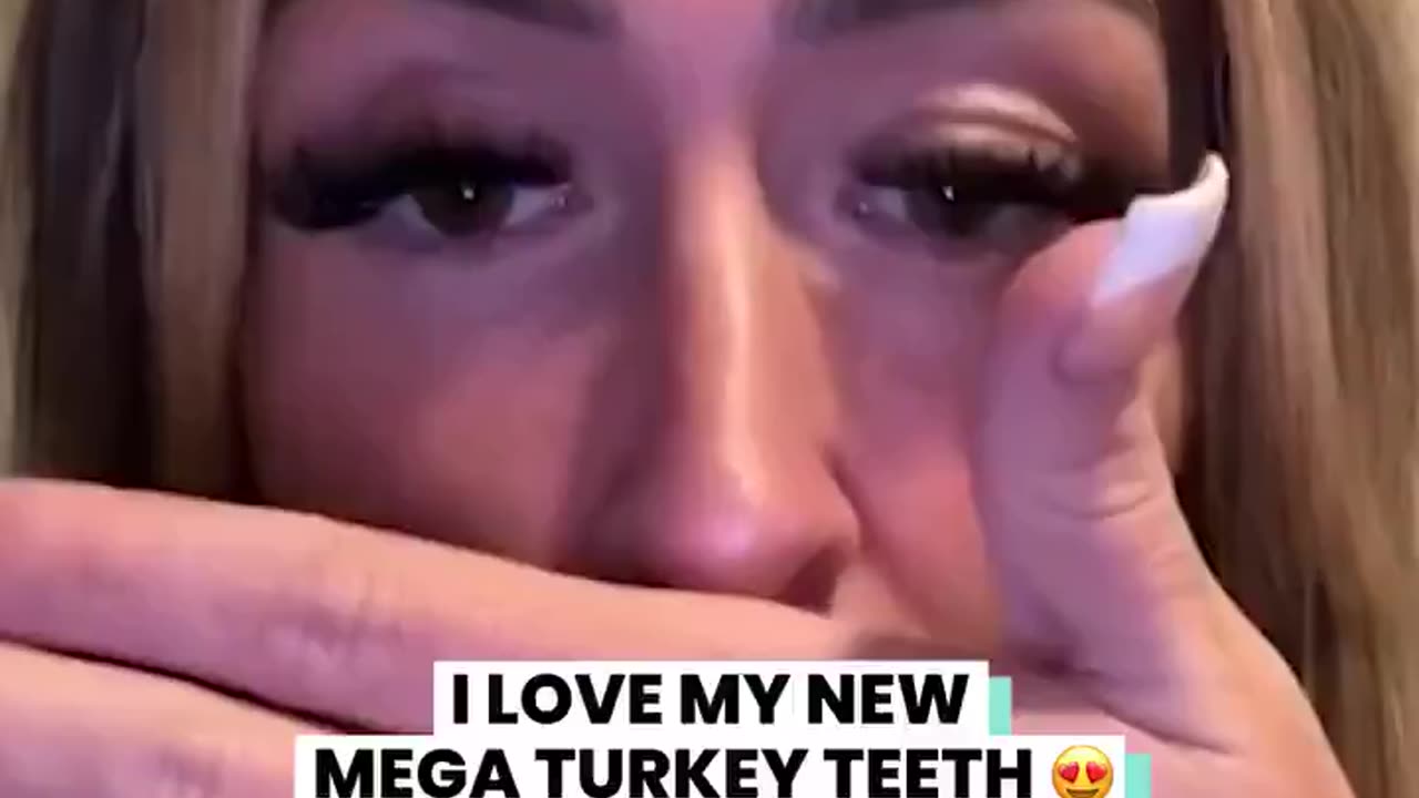 Perfect Smile?