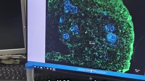 Researchers at King's College London have successfully grown a tooth in a laboratory setting
