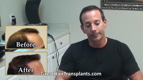 Life-Changing Corrective Hair Transplant by Dr. Brett Bolton