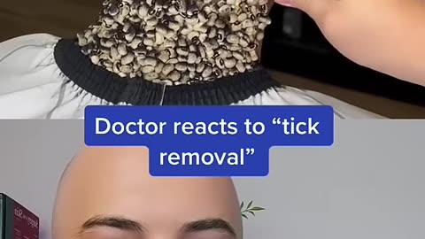 Crazy tick removal? Or fake?
