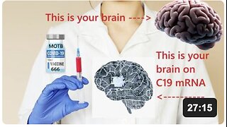 The Neuralink was Injected into the COVID 19 Vaccinated by DARPA Injectable Brain Computer Interface