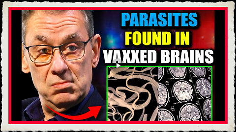 Scientists Discover Parasitic Entities in Brains of Jabbed - Media Blackout