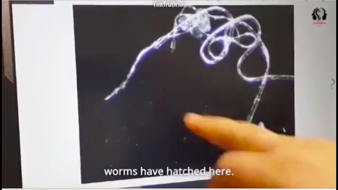 Parasite Eggs in Pfizer Vaccine