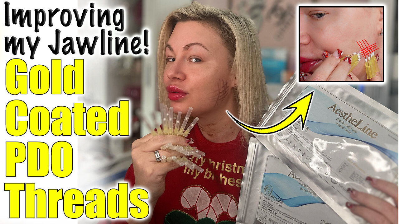 Improving my Jawline with GOLD Coated PDO Threads! AceCosm.com and code Jessica10 saves