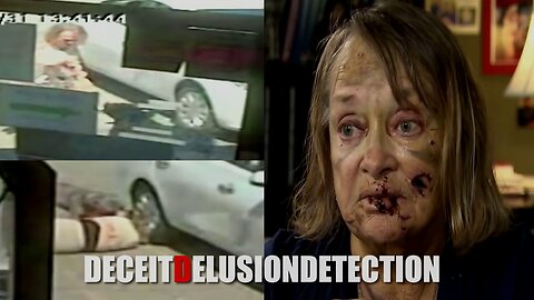 A white grandma was brutally attacked by a black man's pit bull in the parking lot