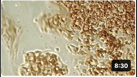 "Scientific Explanation of ClO2's Effectiveness Against Covid-19 by Andreas Kalcker"