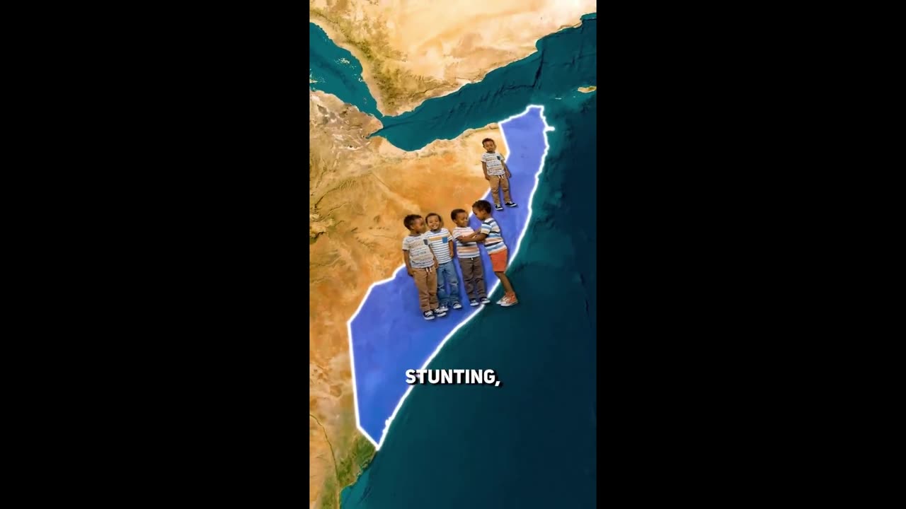 🫣 Why the Average IQ in Somalia is 67 🫣