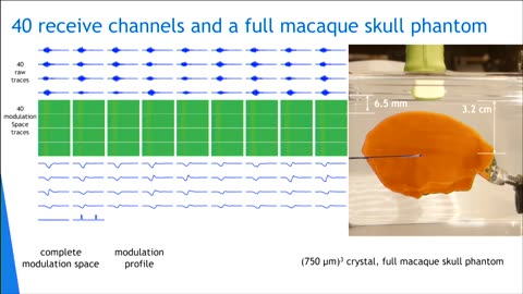 Recent Advances in the Neural Dust Platform - IEEE Brain Workshop 2018
