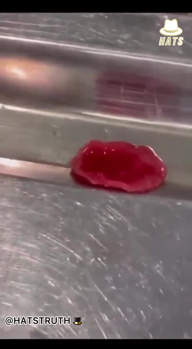 מטורף חתיכת כבד שהוצאה מבנאדם שעשה חיסוני קורונה למה הוא זז למה הוא זז