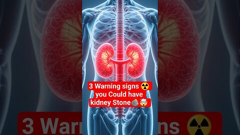 3 Warning Signs You Might Have Kidney Stones 😱🪨 | Don’t Ignore These Symptoms! #Shorts #Health