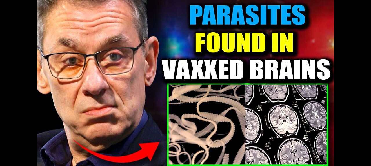 PARASITES FOUND IN BRAINS OF VXXX'D