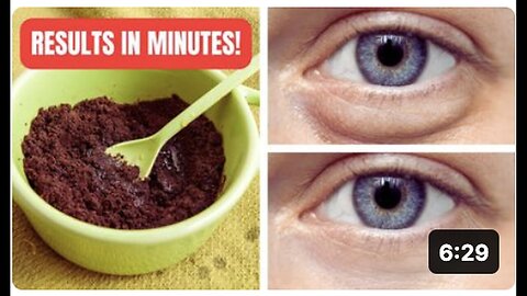 "Miraculous Oil Drop Eliminates Age Spots Overnight"