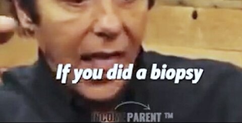 Get a Biopsy, You SPREAD the CANCER!! Dr Thomas Lodi, MD. -