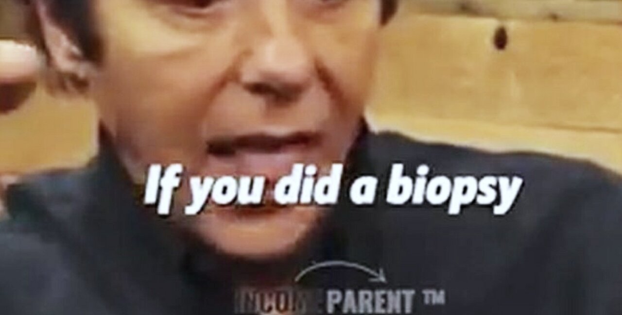 Get a Biopsy, You SPREAD the CANCER!! Dr Thomas Lodi, MD. -