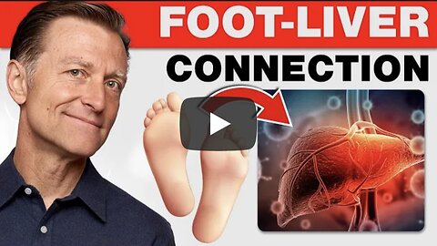 How Your Feet Are Warning You About Your Liver Problems -Dr. Berg Explains