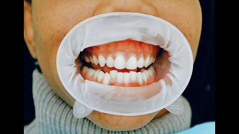 Health reform: how to heal your teeth and gums naturally