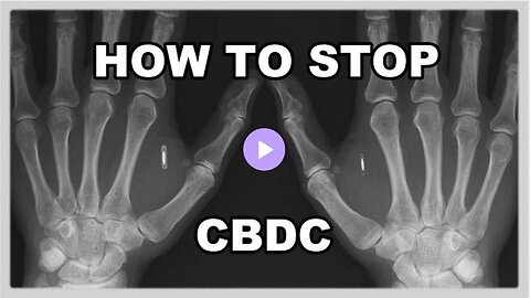 [Jul 19, 2023] Banking Insider Warns CBDCs Will Be Implanted Chips [Reese Report]