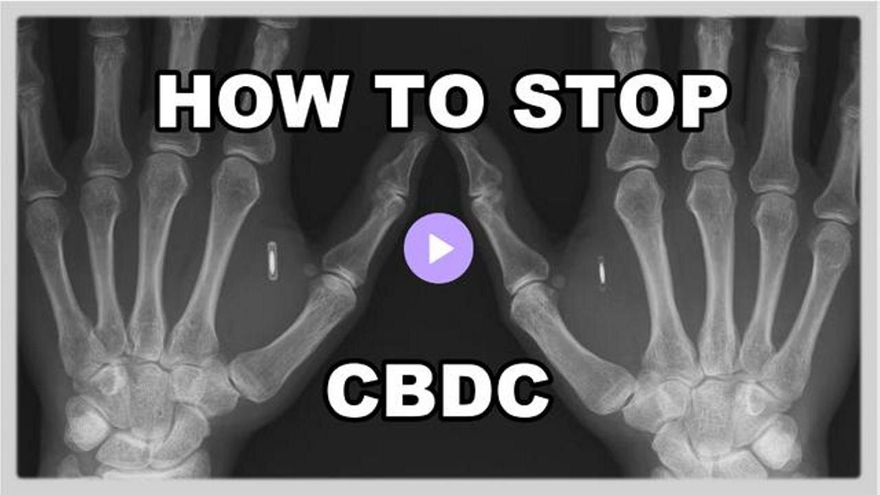 [Jul 19, 2023] Banking Insider Warns CBDCs Will Be Implanted Chips [Reese Report]